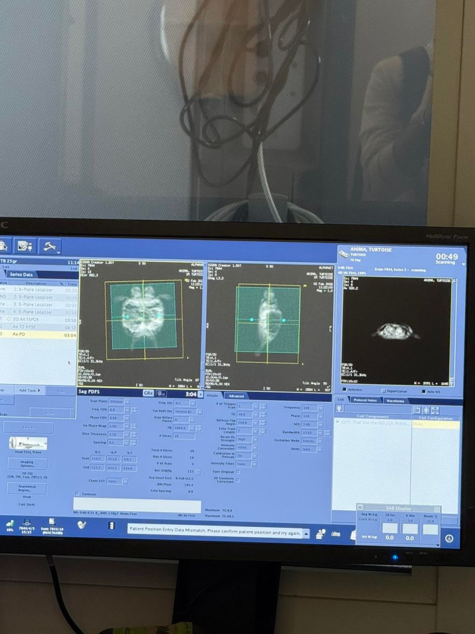 Εξετάσεις της χελώνας με δικεφαλία