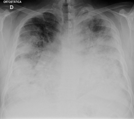 pmc5258191cureus-0008-00000000937-i01.jpg